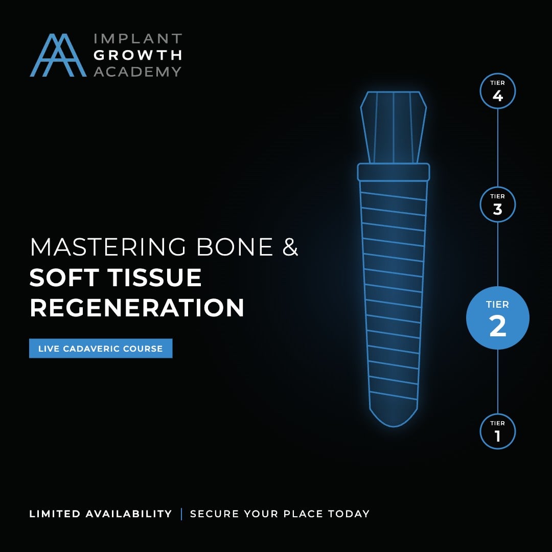 Implant Growth Academy TIER 2 course cover